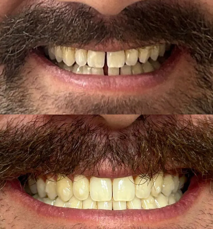 Paciente 1 Ortodontia